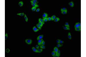 Immunofluorescence staining of HepG2 cells with ABIN7161093 at 1:100, counter-stained with DAPI.