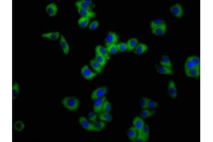 Immunofluorescence staining of HepG2 cells with ABIN7161093 at 1:100, counter-stained with DAPI. (SLC11A2 anticorps  (AA 1-69))