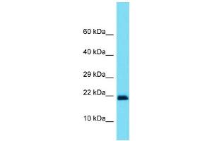 Host: Rabbit Target Name: SOD1 Sample Type: Placenta lysates Antibody Dilution: 1. (SOD1 anticorps  (C-Term))
