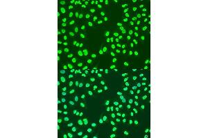 Immunofluorescence analysis of U2OS cells using CBX3 antibody. (CBX3 anticorps  (AA 1-183))