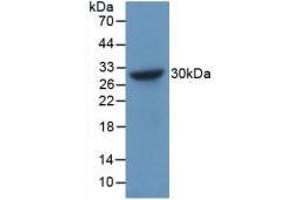 Detection of Recombinant CHGB, Human using Polyclonal Antibody to Chromogranin B (CHGB) (CHGB anticorps  (AA 496-669))