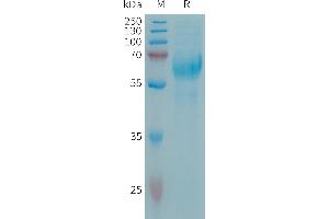 Human C Protein, His Tag on SDS-PAGE under reducing condition.