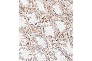 Immunohistochemical analysis of paraffin-embedded human colon tissue using (ABIN389185 and ABIN2839348) performed on the Leica® BOND RXm. (WIF1 anticorps  (C-Term))