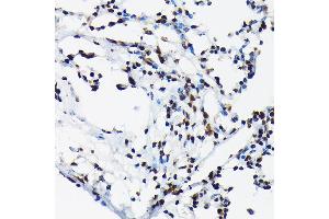 Immunohistochemistry of paraffin-embedded rat lung using Phospho-c-Jun-T91 Rabbit pAb (ABIN7268058) at dilution of 1:50 (40x lens). (C-JUN anticorps  (pThr91))