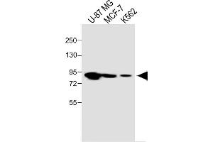 All lanes :PLOD1 Antibody (N-term) at 1:1000 dilution Lane 1: U-87 MG whole cell lysate Lane 2: MCF-7 whole cell lysate Lane 3: K562 whole cell lysate Lysates/proteins at 20 μg per lane. (PLOD1 anticorps  (N-Term))