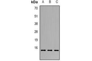 Western blot analysis of GILZ expression in BT474 (A), Raji (B), mouse slpeen (C) whole cell lysates.