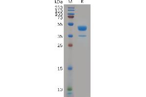 Human C Protein, hFc Tag on SDS-PAGE under reducing condition.