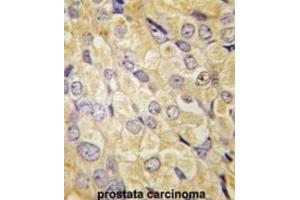 Immunohistochemistry (IHC) image for anti-Frizzled Family Receptor 1 (Fzd1) antibody (ABIN3001613) (FZD1 anticorps)