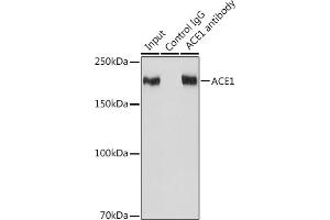 Immunoprecipitation analysis of 600 μg extracts of Mouse kidney cells using 3 μg  antibody (ABIN7265594).