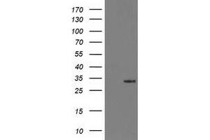 Western Blotting (WB) image for anti-Hydroxyprostaglandin Dehydrogenase 15-(NAD) (HPGD) antibody (ABIN1496363)