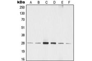 Western blot analysis of 14-3-3 zeta (pS58) expression in MCF7 (A), A549 (B), SP2/0 (C), rat liver (D), NIH3T3 (E), A431 (F) whole cell lysates.