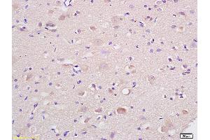 Formalin-fixed and paraffin embedded rat brain labeled with Anti-HSP75/TRAP1 Polyclonal Antibody, Unconjugated (ABIN686647) at 1:200 followed by conjugation to the secondary antibody and DAB staining. (TRAP1 anticorps  (AA 501-650))