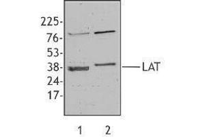 Western Blotting (WB) image for anti-Linker For Activation of T Cells (LAT) antibody (ABIN2666055) (LAT anticorps)