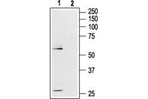 Western blot analysis of rat hippocampus lysate: - 1. (Mu Opioid Receptor 1 anticorps  (Extracellular, N-Term))