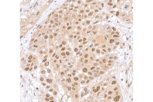 Immunohistochemistry (IHC) image for anti-HECT, UBA and WWE Domain Containing 1, E3 Ubiquitin Protein Ligase (HUWE1) (AA 2250-2300) antibody (ABIN7453974)