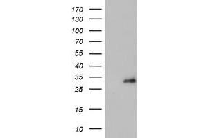 Western Blotting (WB) image for anti-Proteasome (Prosome, Macropain) Subunit, beta Type, 4 (PSMB4) antibody (ABIN1500474) (PSMB4 anticorps)