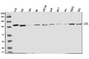Western blot analysis of CBL using anti-CBL antibody (ABIN7601820).