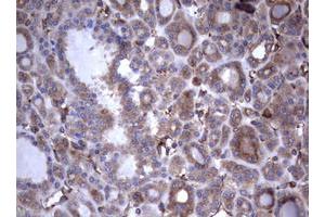 Image no. 17 for anti-Tumor Necrosis Factor Receptor Superfamily, Member 8 (TNFRSF8) (AA 19-379) antibody (ABIN1491084)