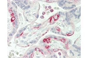 Formalin-fixed and paraffin-embedded H.