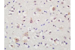 Formalin-fixed and paraffin embedded rat brain labeled with Rabbit Anti-NTR3 Polyclonal Antibody, Unconjugated (ABIN872315) at 1:200 followed by conjugation to the secondary antibody and DAB staining (Sortilin 1 anticorps  (AA 731-831))