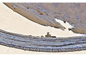 IHC analysis of Alpha B Crystallin/CRYAB using anti-Alpha B Crystallin/CRYAB antibody (ABIN7601209). (CRYAB anticorps  (AA 30-151))