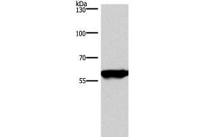 Western Blot analysis of Mouse brain tissue using PPP3CA Polyclonal Antibody at dilution of 1:900 (PPP3CA anticorps)