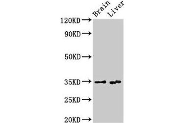 Ribokinase anticorps  (AA 2-322)