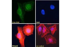 ABIN184780 Immunofluorescence analysis of paraformaldehyde fixed HeLa cells, permeabilized with 0.