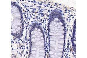 Immunohistochemistry analysis of paraffin-embedded human stomach using,PARN (ABIN7075117) at dilution of 1: 1800 (PARN anticorps)