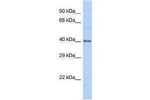 Host:  Rabbit  Target Name:  HKR1  Sample Type:  Hela Whole Cell lysates  Antibody Dilution:  1. (HKR1 anticorps  (C-Term))