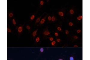 Immunofluorescence analysis of C6 cells using HNRNPU Polyclonal Antibody at dilution of 1:100. (HNRNPU anticorps)