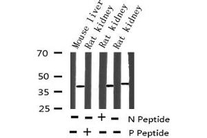 PRKAB1 antibody  (pSer181)