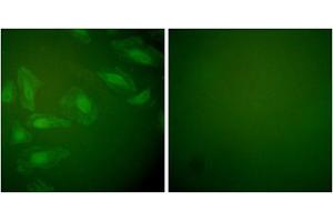 Immunofluorescence analysis of HeLa cells, using DJ-1 antibody (ABIN5976380).
