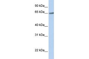 WB Suggested Anti-TM9SF1 Antibody Titration:  0. (TM9SF1 anticorps  (N-Term))