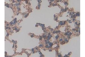 Detection of RAGE in Rat Lung Tissue using Polyclonal Antibody to Receptor For Advanced Glycation Endproducts (RAGE)