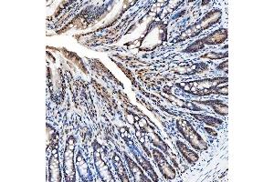 IHC analysis of SNRNP200 using anti-SNRNP200 antibody (ABIN7602032).