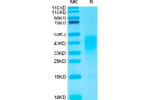 Biotinylated IL-13 on Tris-Bis PAGE under reduced conditions.