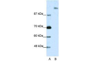 WB Suggested Anti-SUPT6H  Antibody Titration: 2. (Spt6 anticorps  (N-Term))