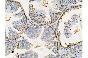 Phospho-SAMHD1 (Thr592) Antibody at 1/100 staining Mouse testis tissue by IHC-P. (SAMHD1 anticorps  (pThr592))
