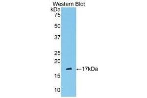 Detection of Recombinant C1INH, Mouse using Polyclonal Antibody to Complement 1 Inhibitor (C1INH)