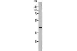 Western Blotting (WB) image for anti-Cholinergic Receptor, Nicotinic, alpha 7 (Neuronal) (CHRNA7) antibody (ABIN2426249) (CHRNA7 anticorps)