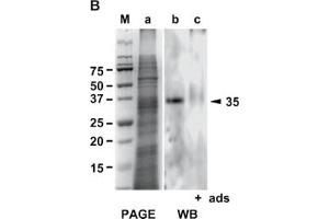 Western Blot analysis of ABIN125786 specificity. (Galectin 2 anticorps)