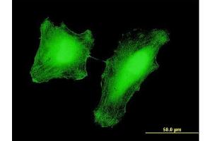 Immunofluorescence of monoclonal antibody to KAT2B on HeLa cell.