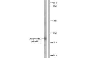 Western blot analysis of extracts from Jurkat cells. (PRKAB1 anticorps  (pSer182))