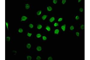 Immunofluorescence staining of A549 cells with ABIN7148764 at 1:100, counter-stained with DAPI.