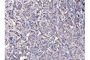 IHC analysis of IMPDH1 using anti-IMPDH1 antibody (ABIN7599864). (IMPDH1 anticorps  (AA 123-500))
