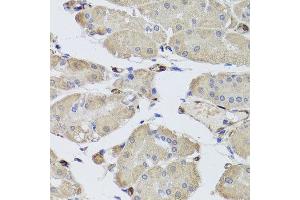Immunohistochemistry of paraffin-embedded human stomach using FABP5 antibody at dilution of 1:100 (x40 lens). (FABP5 anticorps)