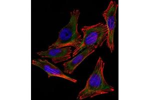 Confocal Immunofluorescent analysis of A2058 cells using AF488-labeled S100B Monoclonal Antibody (4C4. (S100B anticorps)