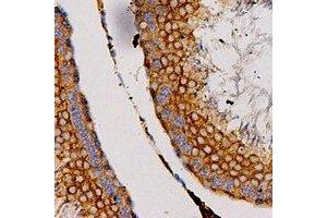 Immunohistochemical analysis of CCL27 staining in human testis formalin fixed paraffin embedded tissue section.
