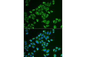 Immunofluorescence analysis of HeLa cells using TAGLN antibody (ABIN5974090). (Transgelin anticorps)